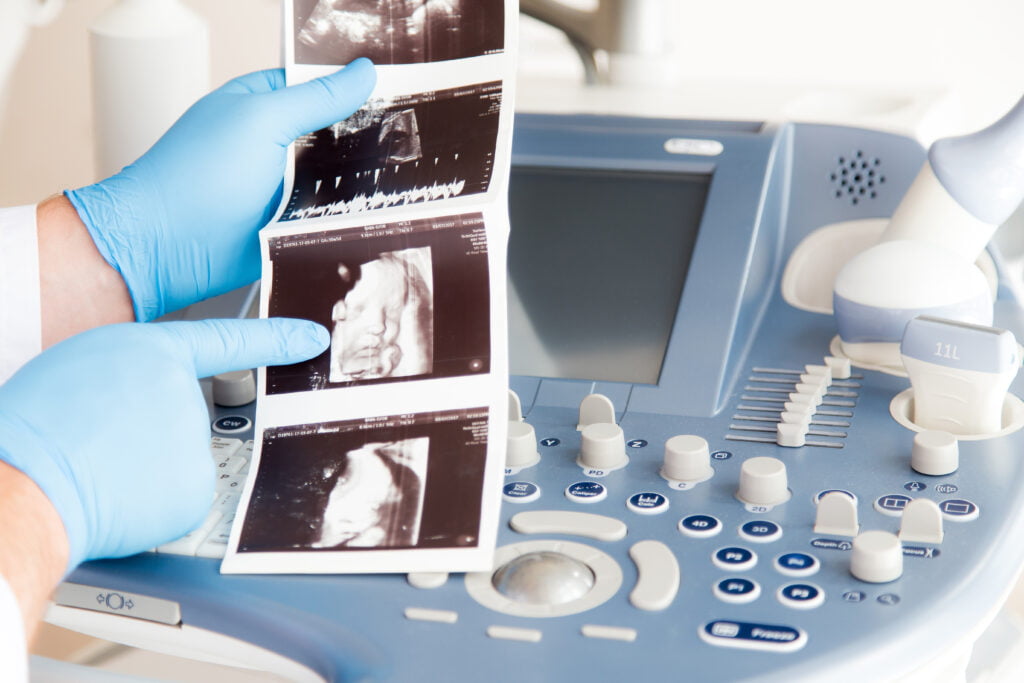 lekarz trzymający w ręku zdjęcie USG wykonane podczas badań prenatalnych